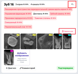 RU (1)